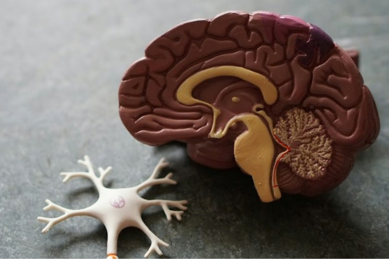 The Brain Game
